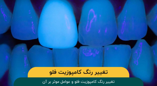 تغییر-رنگ-کامپوزیت-فلو